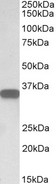CD20 Antibody - Western blot analysis of Anti-CD20 antibody (LS-B11144, 0.05 µg/ml; 35 µg of protein in RIPA buffer). Lane 1: Human Lymph Node lysate. Antibody produced band at ~33 kDa.