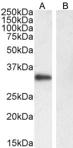 CD20 Antibody - Western blot analysis of Anti-CD20 antibody (LS-B11144, 0.01 µg/ml; 35 µg of protein in RIPA buffer). Lane 1: Daudi cell lysate. Lane 2: HepG2 cell lysate as negative control. Antibody produced band at ~33 kDa in Daudi cell lysate, produced no band in negative control HepG2 cell lysate.