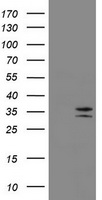 CD20 Antibody - HEK293T cells were transfected with the pCMV6-ENTRY control (Left lane) or pCMV6-ENTRY MS4A1 (Right lane) cDNA for 48 hrs and lysed. Equivalent amounts of cell lysates (5 ug per lane) were separated by SDS-PAGE and immunoblotted with anti-MS4A1.