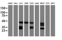 CD20 Antibody - Western blot of extracts (35 ug) from 9 different cell lines by using anti-MS4A1 monoclonal antibody (HepG2: human; HeLa: human; SVT2: mouse; A549: human; COS7: monkey; Jurkat: human; MDCK: canine; PC12: rat; MCF7: human).