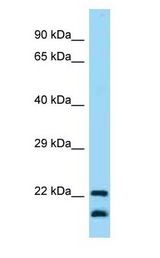 CD200 Antibody - CD200 antibody Western Blot of Human fetal lung lysate. Antibody dilution: 1 ug/ml.  This image was taken for the unconjugated form of this product. Other forms have not been tested.