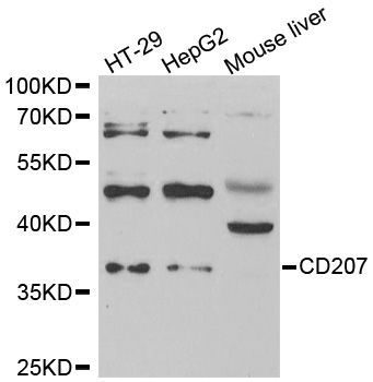 CD207 / Langerin Antibody - Western blot analysis of extracts of various cell lines.