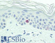 CD207 / Langerin Antibody - Human Skin: Formalin-Fixed, Paraffin-Embedded (FFPE)