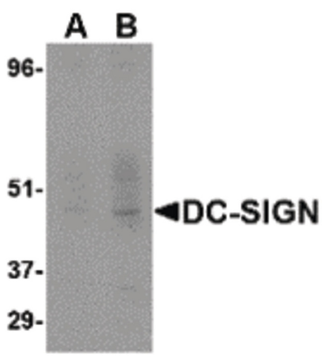 CD209 / DC-SIGN Antibody - Western blot detection of DC-SIGN fusion protein in human placenta at (A) 1 and (B) 2 ug/ml.