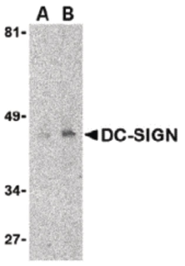 CD209 / DC-SIGN Antibody - Western blot detection of DC-SIGN fusion protein in human uterus tissue lysate at (A) 1 and (B) 2 ug/ml.