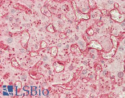 CD209 / DC-SIGN Antibody - Human Liver: Formalin-Fixed, Paraffin-Embedded (FFPE)