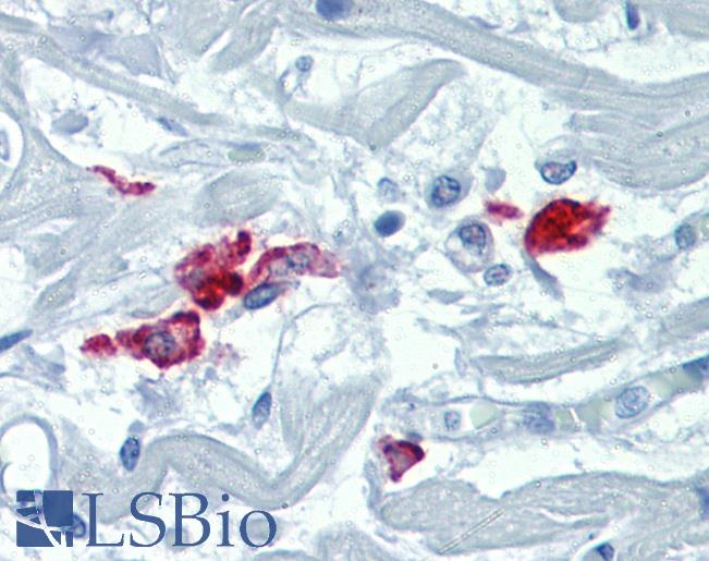 CD209 / DC-SIGN Antibody - Anti-CD209 / DC-SIGN antibody IHC of human heart. Immunohistochemistry of formalin-fixed, paraffin-embedded tissue after heat-induced antigen retrieval. Antibody concentration 20 ug/ml.