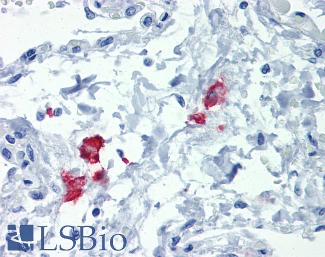 CD209 / DC-SIGN Antibody - Anti-CD209 / DC-SIGN antibody IHC of human lung. Immunohistochemistry of formalin-fixed, paraffin-embedded tissue after heat-induced antigen retrieval. Antibody concentration 20 ug/ml.