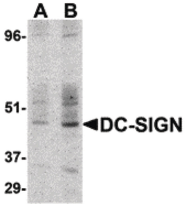 CD209 / DC-SIGN Antibody - Western blot detection of DC-SIGN in human small intestine at (A) 1 and (B) 2 ug /ml.