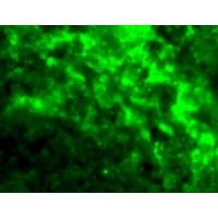CD209 / DC-SIGN Antibody - Immunofluorescence of DC-SIGN in Human Lymph Node tissue with DC-SIGN antibody at 20 µg/mL.