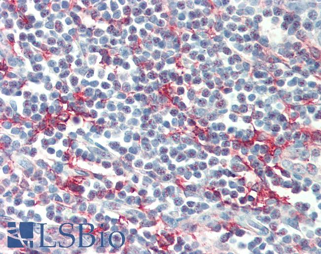 CD209 / DC-SIGN Antibody - Anti-CD209 / DC-SIGN antibody IHC of human tonsil. Immunohistochemistry of formalin-fixed, paraffin-embedded tissue after heat-induced antigen retrieval. Antibody concentration 5 ug/ml.