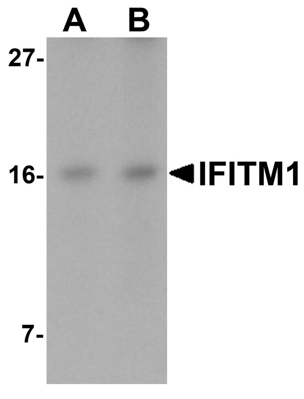 CD225 / IFITM1 Antibody - Western blot analysis of IFITM1 in Jurkat cell lysate with IFITM1 antibody at (A) 2.5 and (B) 5 ug/ml.