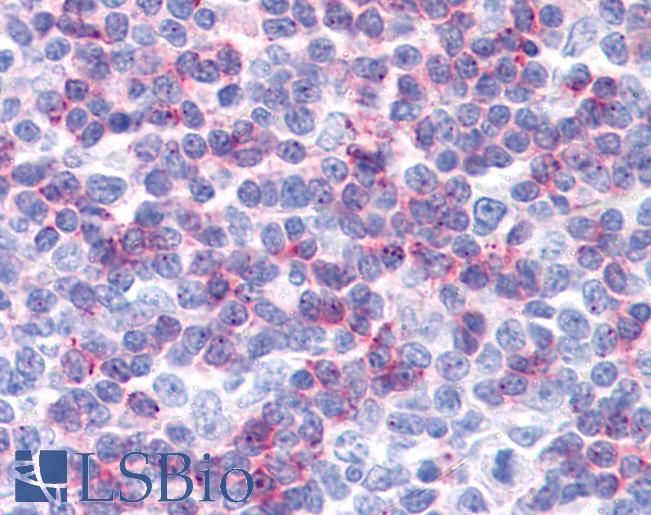 CD225 / IFITM1 Antibody - Anti-IFITM1 antibody IHC of human tonsil. Immunohistochemistry of formalin-fixed, paraffin-embedded tissue after heat-induced antigen retrieval. Antibody concentration 10 ug/ml.