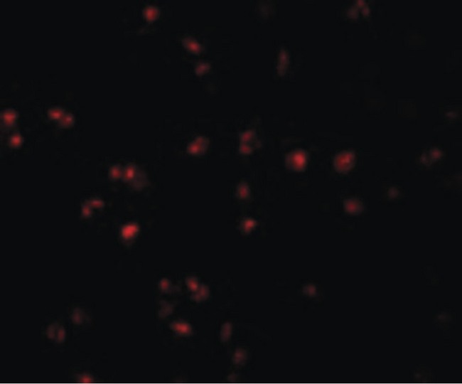 CD225 / IFITM1 Antibody - Immunofluorescence of IFITM1 in Jurkat cells with IFITM1 antibody at 20 ug/ml.