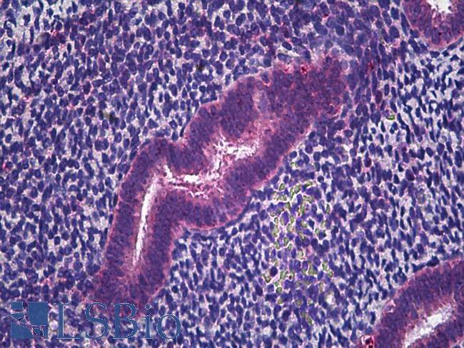 CD225 / IFITM1 Antibody - Anti-IFITM1 antibody IHC of human uterus, endometrium. Immunohistochemistry of formalin-fixed, paraffin-embedded tissue after heat-induced antigen retrieval. Antibody concentration 5 ug/ml.
