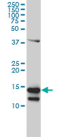 CD247 / CD3 Zeta Antibody - Western blot of CD247 expression in Jurkat cell lysate..
