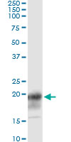 CD247 / CD3 Zeta Antibody - Immunoprecipitation of CD247 transfected lysate using anti-CD247 monoclonal antibody and Protein A Magnetic Bead.