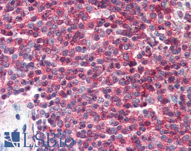 CD27 Antibody - Anti-CD27 antibody IHC of human spleen. Immunohistochemistry of formalin-fixed, paraffin-embedded tissue after heat-induced antigen retrieval. Antibody concentration 10 ug/ml. This image was taken for the unconjugated form of this product. Other forms have not been tested.