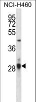 CD274 / B7-H1 / PD-L1 Antibody - CD274 Antibody western blot of NCI-H460 cell line lysates (35 ug/lane). The CD274 antibody detected the CD274 protein (arrow).