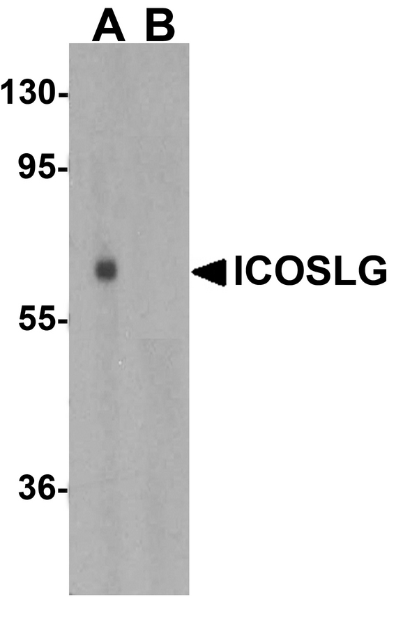 CD275 / B7-H2 / ICOS Ligand Antibody - Western blot analysis of ICOSLG in human lymph node tissue lysate with ICOSLG antibody at 1 ug/mL in (A) the absence and (B) the presence of blocking peptide.
