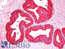 CD275 / B7-H2 / ICOS Ligand Antibody - Human Prostate: Formalin-Fixed, Paraffin-Embedded (FFPE)