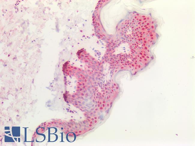 CD276 / B7-H3 Antibody - Human Skin: Formalin-Fixed, Paraffin-Embedded (FFPE)