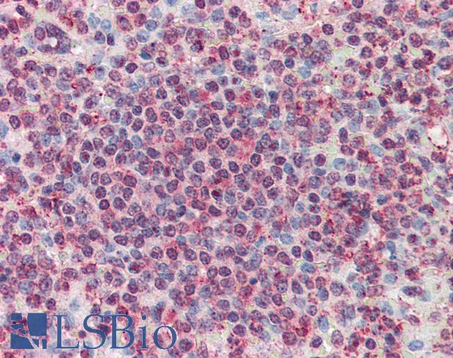 CD27L / CD70 Antibody - Anti-CD70 antibody IHC of human spleen. Immunohistochemistry of formalin-fixed, paraffin-embedded tissue after heat-induced antigen retrieval.