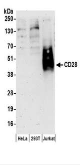 CD28 Antibody - Detection of Human CD28 by Western Blot. Samples: Whole cell lysate (50 ug) prepared using NETN buffer from HeLa, 293T, and Jurkat cells. Antibodies: Affinity purified rabbit anti-CD28 antibody used for WB at 0.4 ug/ml. Detection: Chemiluminescence with an exposure time of 3 minutes.