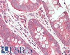 CD28 Antibody - Human Small Intestine: Formalin-Fixed, Paraffin-Embedded (FFPE)