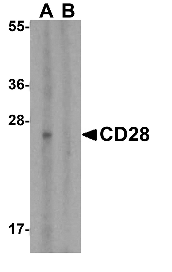 CD28 Antibody - Western blot analysis of CD28 in human spleen tissue lysate with CD28 antibody at 1 ug/mL in (A) the absence and (B) the presence of blocking peptide.