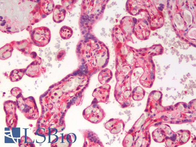 CD28 Antibody - Human Placenta: Formalin-Fixed, Paraffin-Embedded (FFPE)