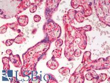 CD28 Antibody - Human Placenta: Formalin-Fixed, Paraffin-Embedded (FFPE)