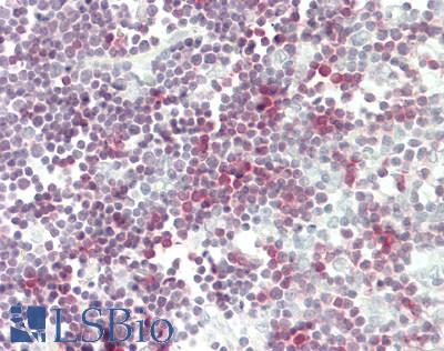 CD3 Antibody - Human Thymus: Formalin-Fixed, Paraffin-Embedded (FFPE)