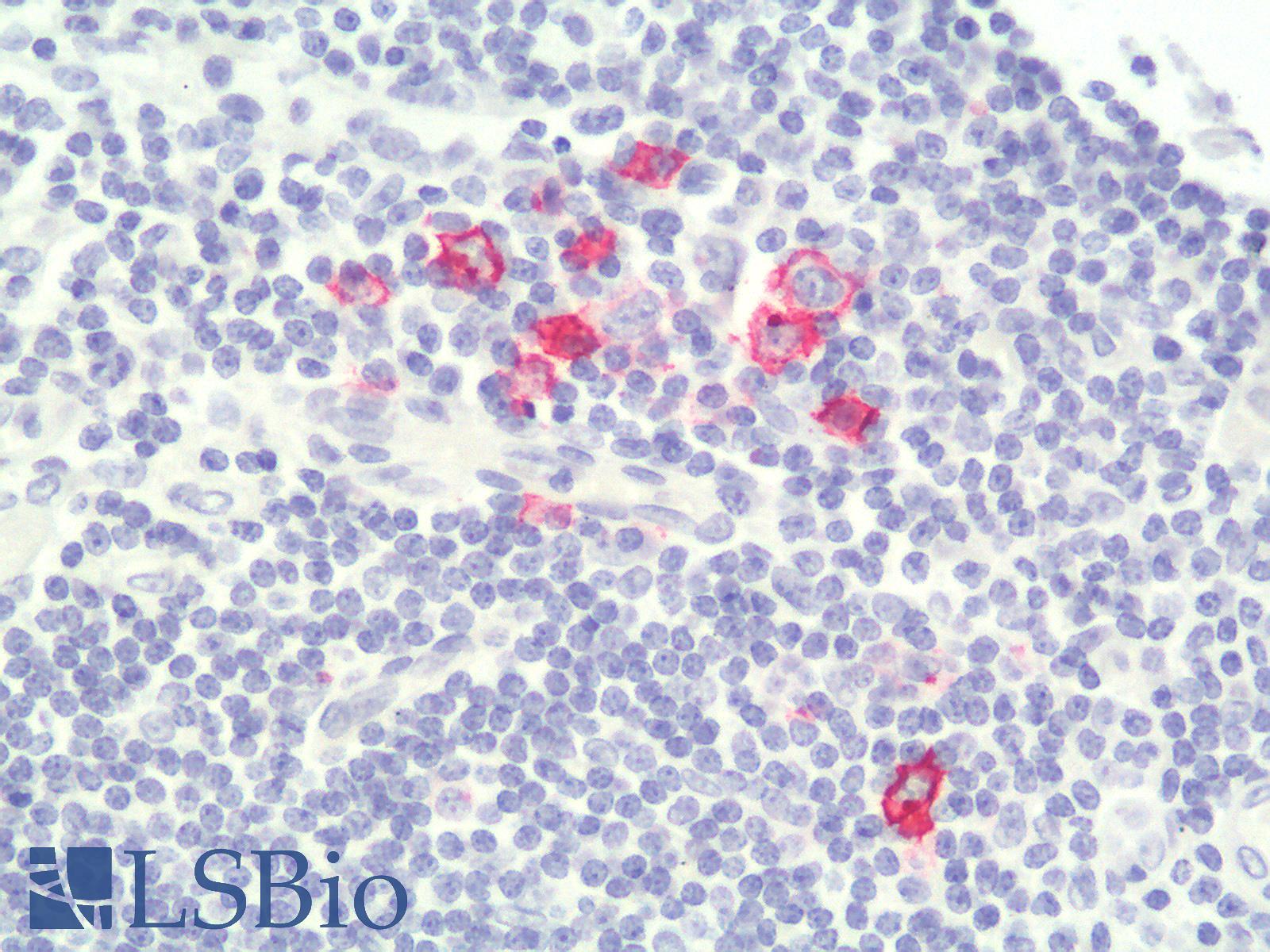 CD30 Antibody - Human Tonsil: Formalin-Fixed, Paraffin-Embedded (FFPE)