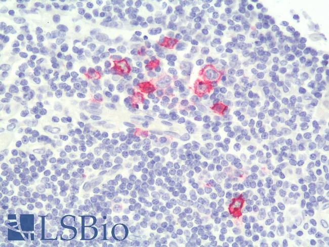 CD30 Antibody - Human Tonsil: Formalin-Fixed, Paraffin-Embedded (FFPE)