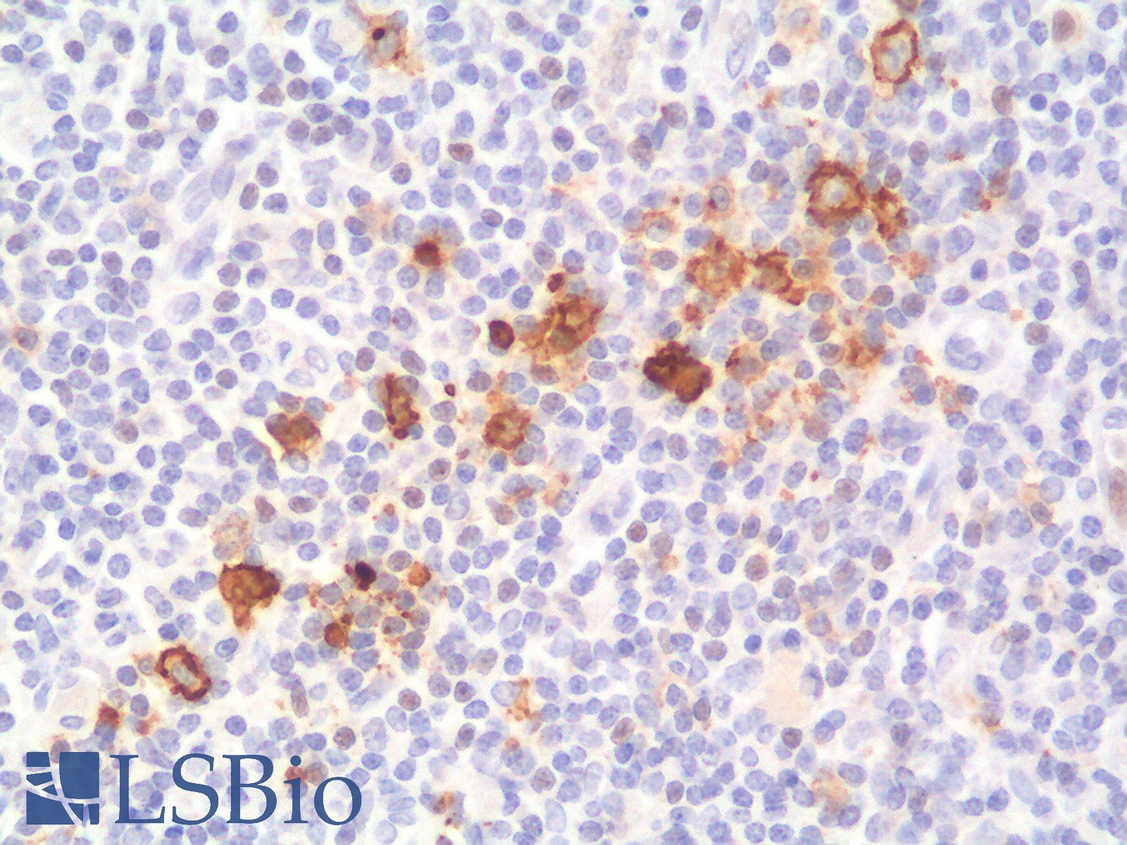 CD30 Antibody - Human Tonsil: Formalin-Fixed, Paraffin-Embedded (FFPE)