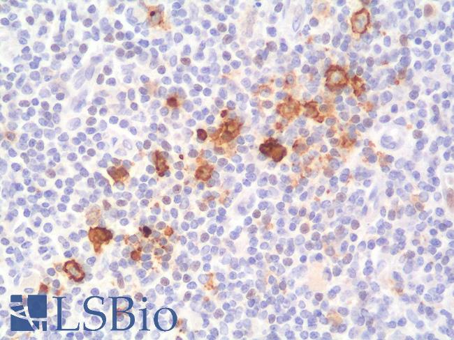 CD30 Antibody - Human Tonsil: Formalin-Fixed, Paraffin-Embedded (FFPE)