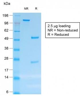 CD30 Antibody - SDS-PAGE Analysis Purified CD30 Mouse Recombinant Monoclonal Antibody (rCD30/412). Confirmation of Purity and Integrity of Antibody.