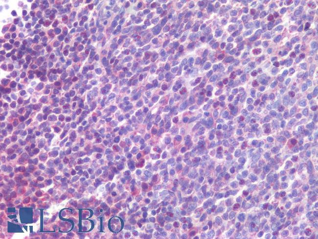 CD300A Antibody - Human Tonsil: Formalin-Fixed, Paraffin-Embedded (FFPE)