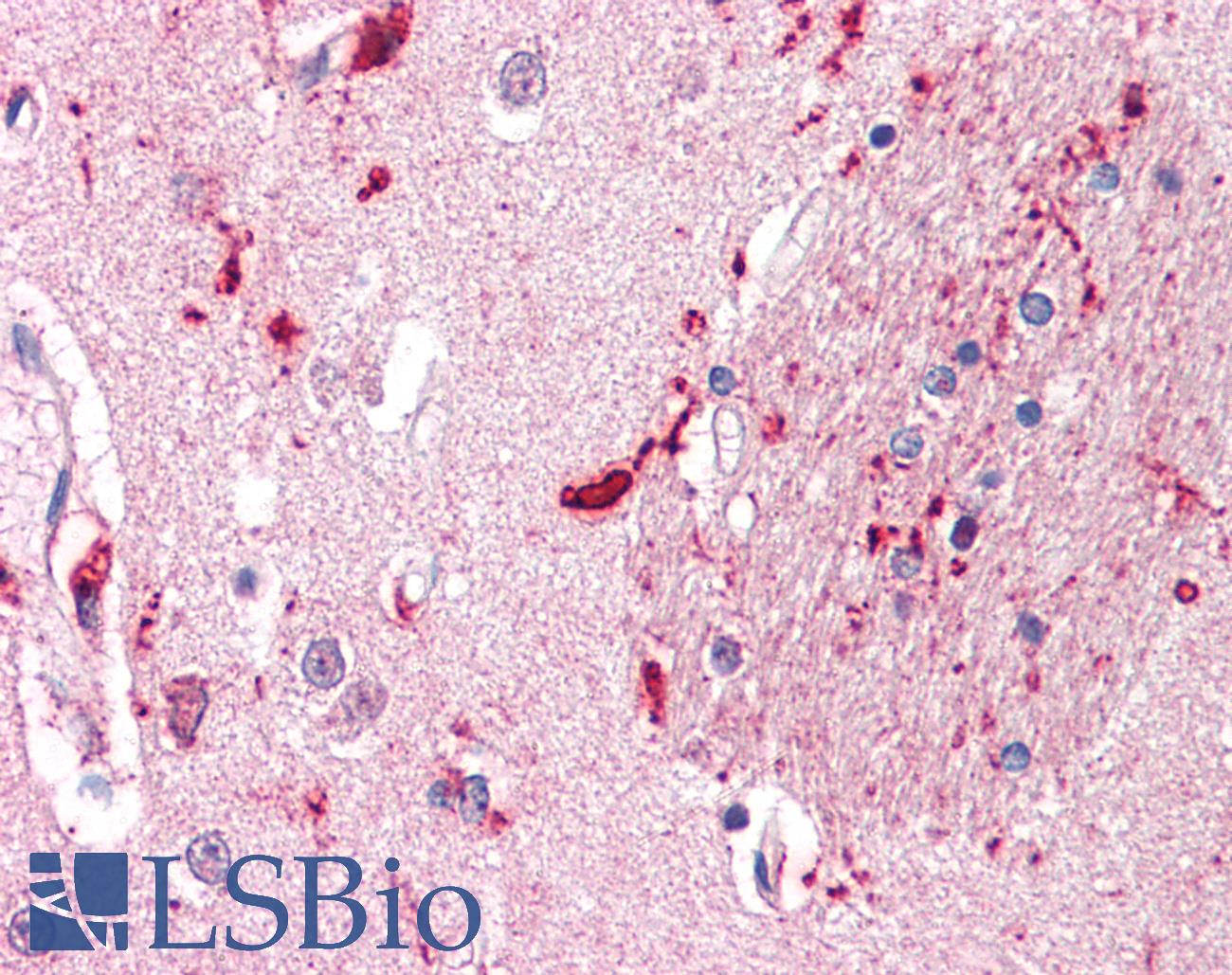 CD316 / IGSF8 Antibody - Anti-IGSF8 antibody IHC of human brain, putamen. Immunohistochemistry of formalin-fixed, paraffin-embedded tissue after heat-induced antigen retrieval.