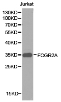 CD32A Antibody - Western blot of extracts of Jurkat cell lines, using FCGR2A antibody.