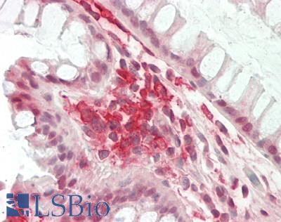CD32A Antibody - Human Colon: Formalin-Fixed, Paraffin-Embedded (FFPE)