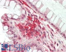 CD32A Antibody - Human Colon: Formalin-Fixed, Paraffin-Embedded (FFPE)