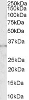 CD32B Antibody - Antibody (0.3 ug/ml) staining of K562 lysate (35 ug protein in RIPA buffer). Primary incubation was 1 hour. Detected by chemiluminescence.