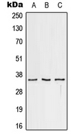 CD32C Antibody - Western blot analysis of CD32c expression in HeLa (A); Raw264.7 (B); PC12 (C) whole cell lysates.
