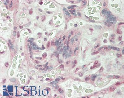 CD32C Antibody - Human Placenta: Formalin-Fixed, Paraffin-Embedded (FFPE)