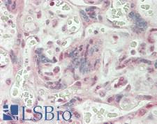 CD32C Antibody - Human Placenta: Formalin-Fixed, Paraffin-Embedded (FFPE)