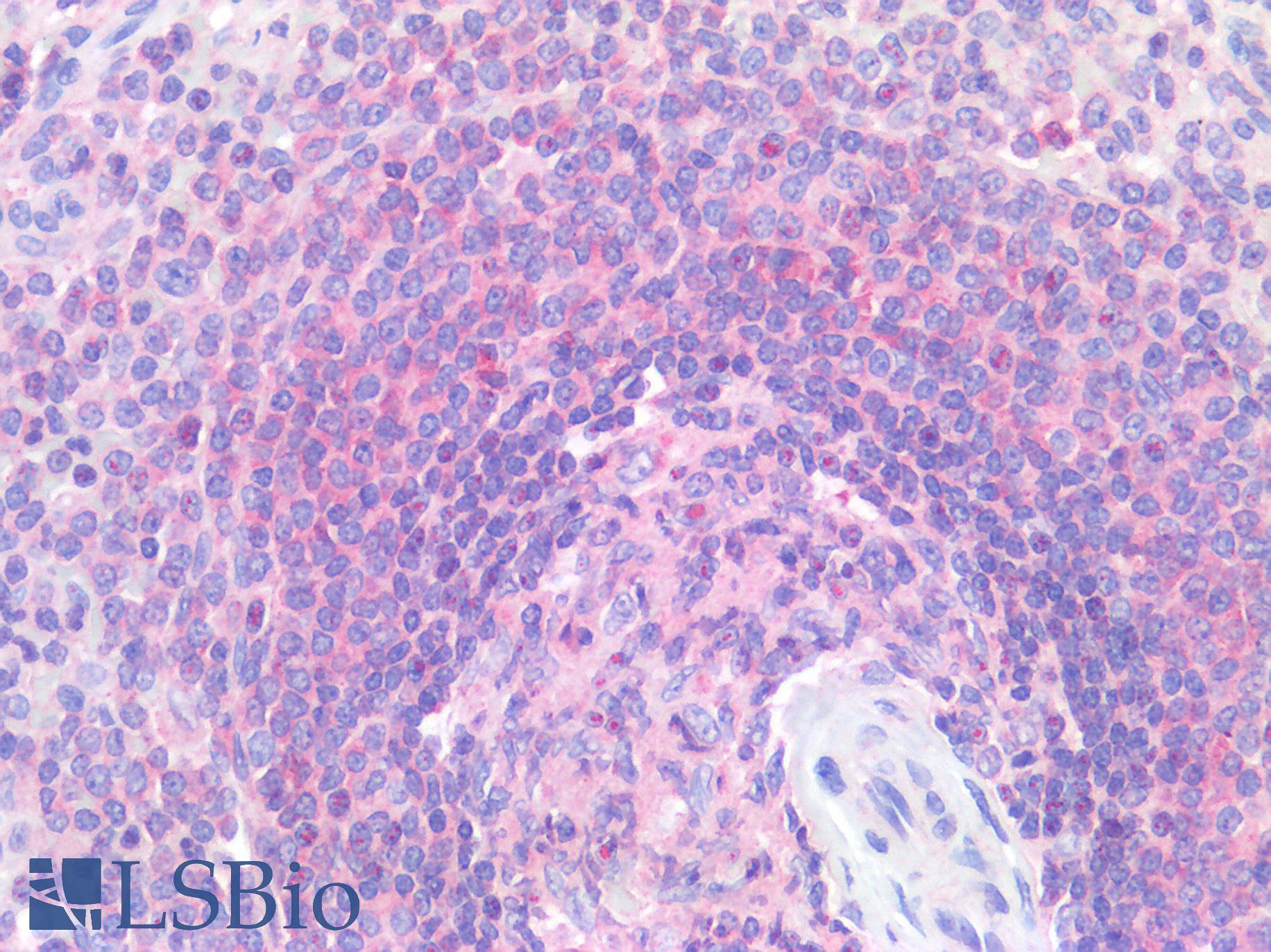CD33 Antibody - Human Spleen: Formalin-Fixed, Paraffin-Embedded (FFPE)