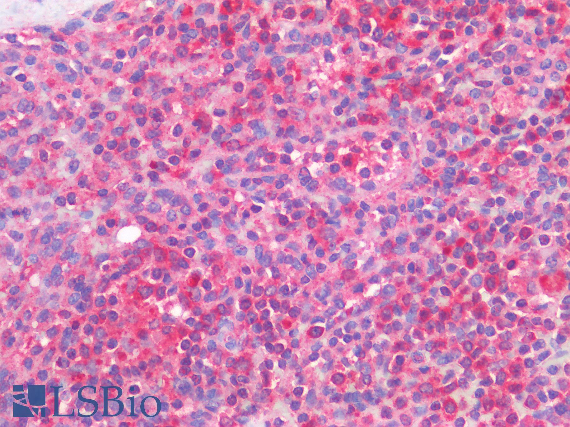 CD33 Antibody - Human Spleen: Formalin-Fixed, Paraffin-Embedded (FFPE)