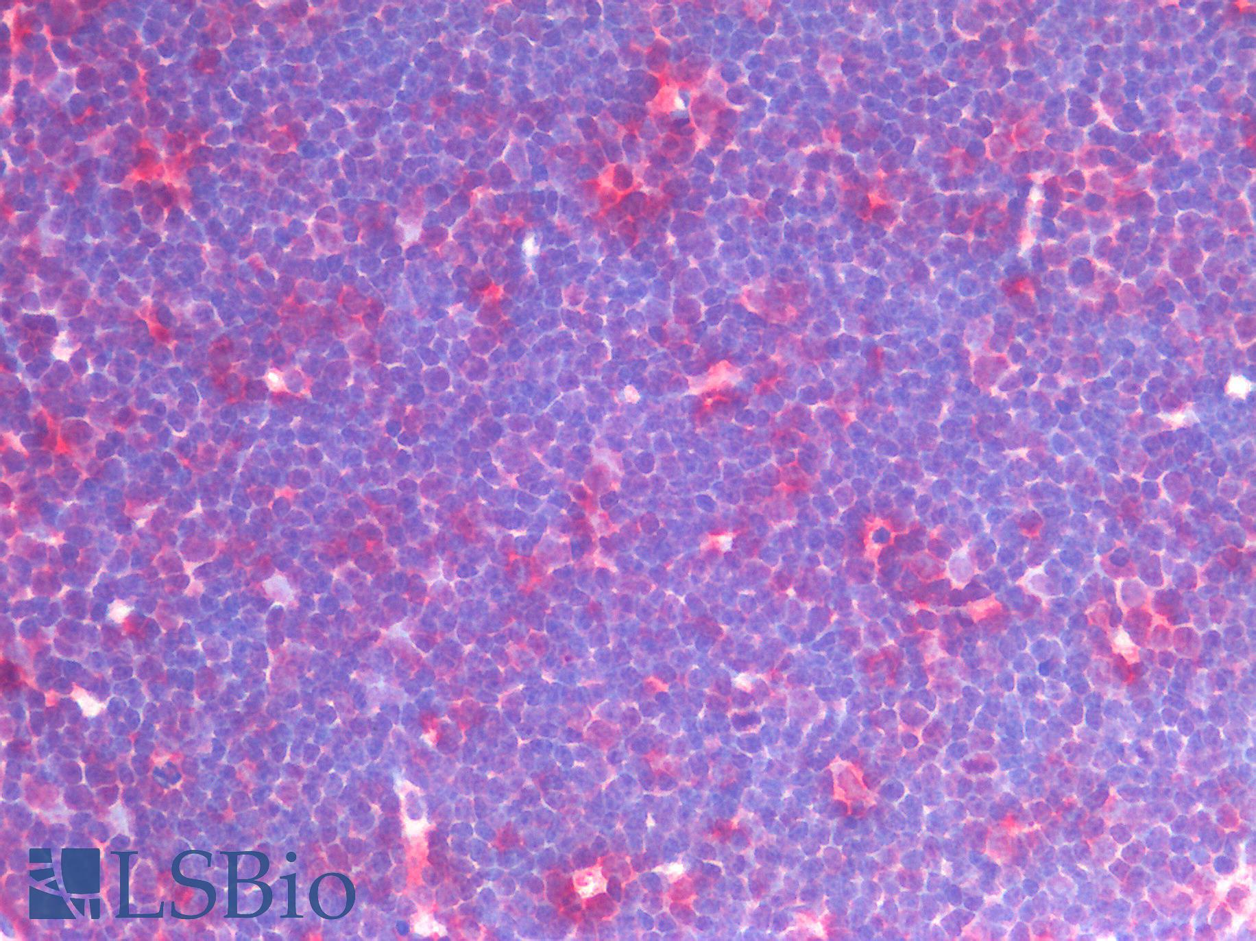 CD33 Antibody - Human Thymus: Formalin-Fixed, Paraffin-Embedded (FFPE)